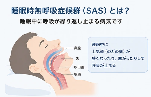 睡眠時無呼吸症候群(SAS)